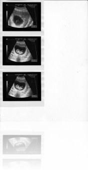 baby scan 2010